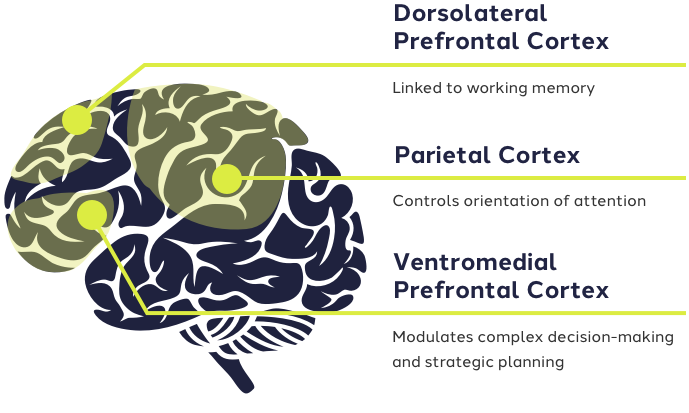 Graphic: ADHD Effects on Brain